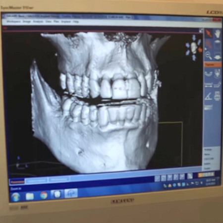 3 D digital x-rays on computer screen