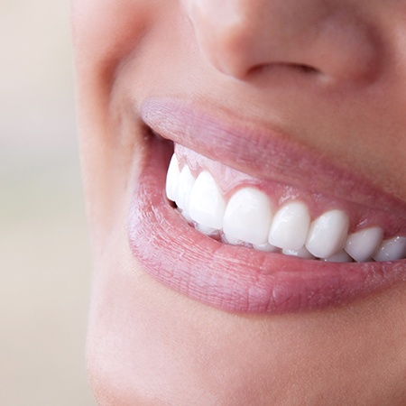 Closeup of smile after esthetic gingival recontouring