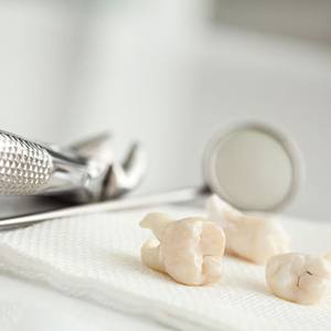 Three extracted teeth next to dental instruments