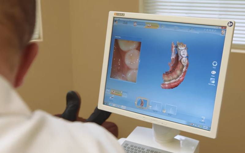 Dentist looking at digital impressions on computer screen