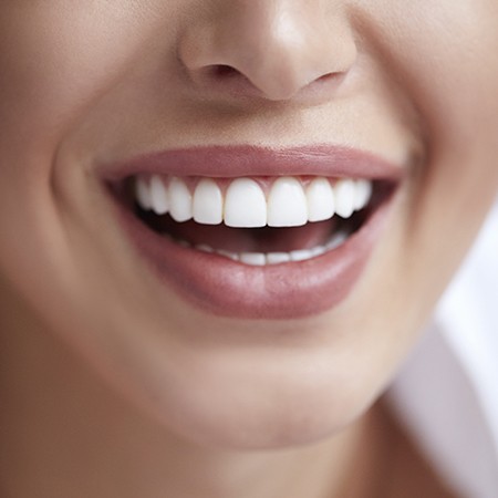 Closeup of healthy smile thanks to the Cordini dental wellness program