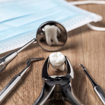 Extracted wisdom tooth gipped in forceps, resting on table