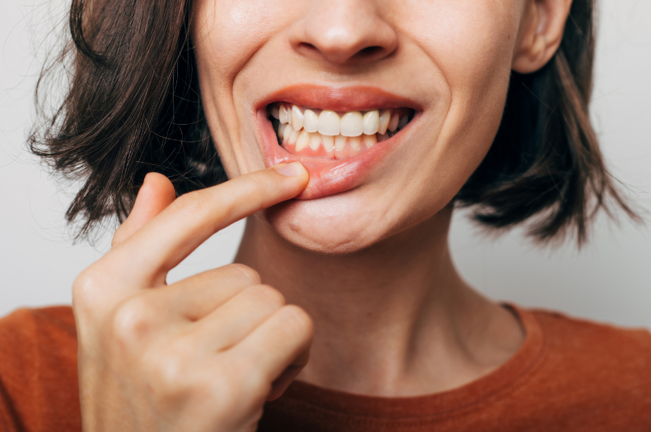 Woman showing gums