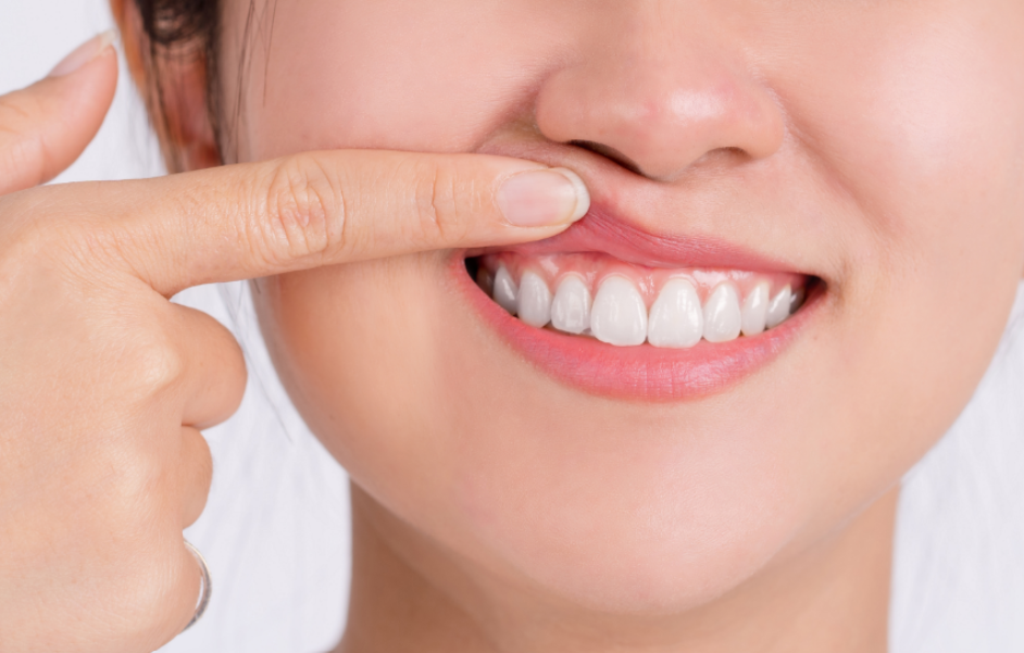 Woman showing gums