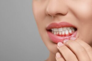 Person pulling down lip to reveal red gums. 